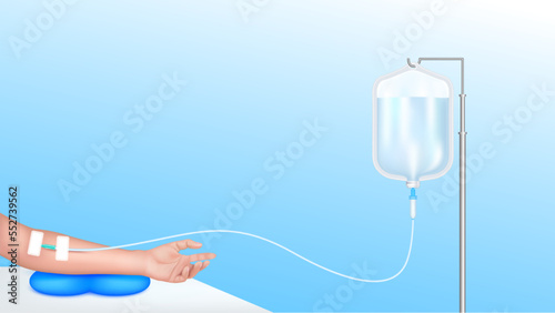 Saline bag solution drip and hand for treatment patient. Vitamin iv fluid intravenous care chemotherapy. Medical and health care concept. Realistic 3D on blue background vector.