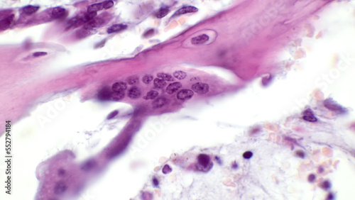 Osteoclast. Light micrograph of an osteoclast displaying typical distinguishing characteristics: a large cell with multiple nuclei. Zoledronic acid inhibits osteoclast differentiation.  photo