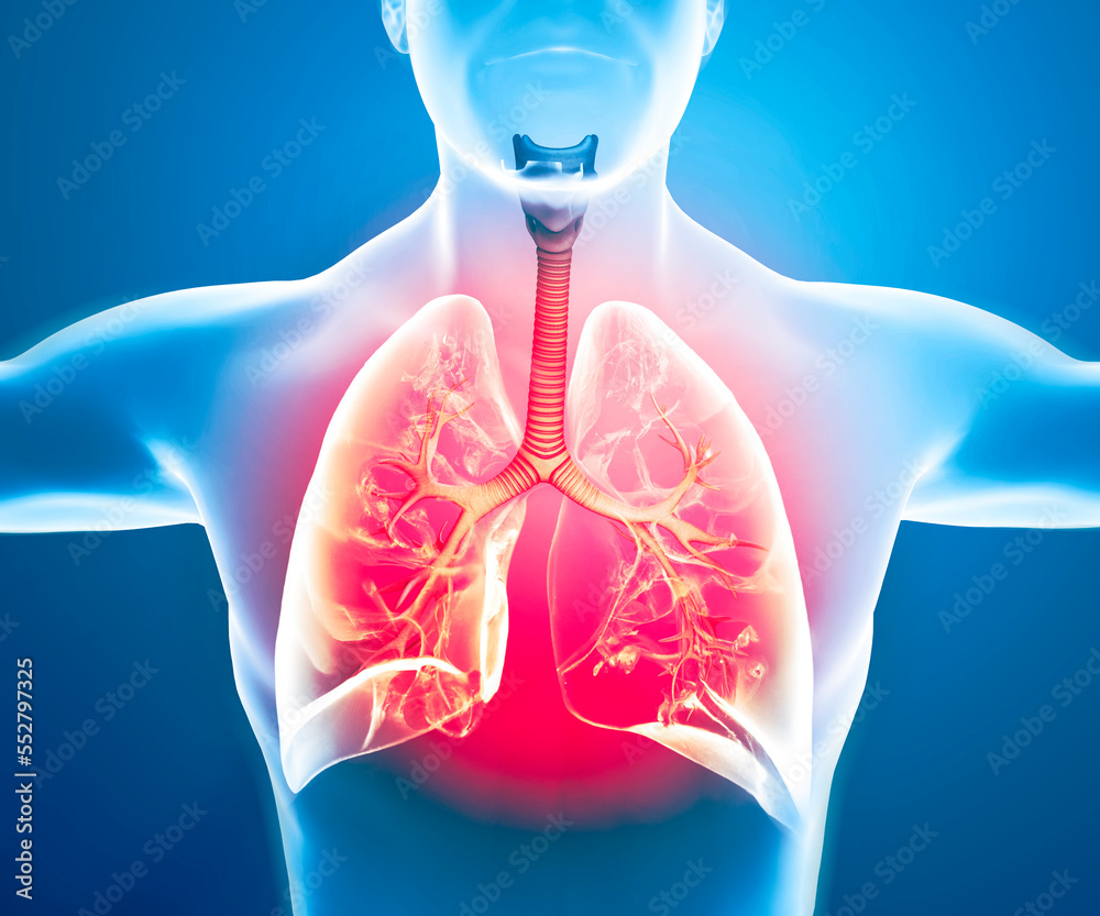 Human anatomy, problems with the respiratory system, severely damaged