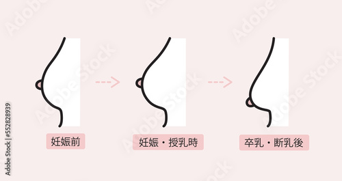 産後のバストのたるみのイラスト