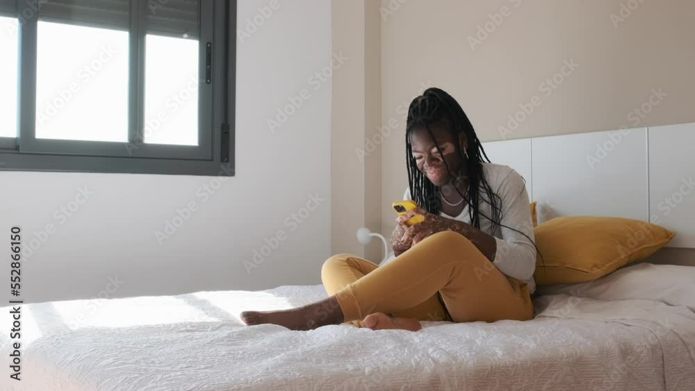 Woman with vitiligo laughing while using the mobile sitting on the bed Woman with vitiligo laughing while using the mobile sitting on the bed