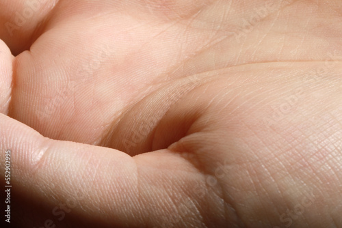 Closeup view of human hand with dry skin © New Africa