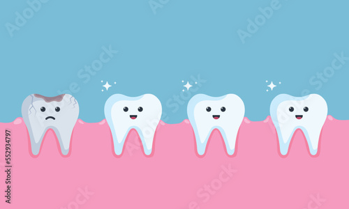 Healthy white teeth and damaged darkened tooth with hole. children dentistry sad character. Dental Infographic elements concept vector illustration