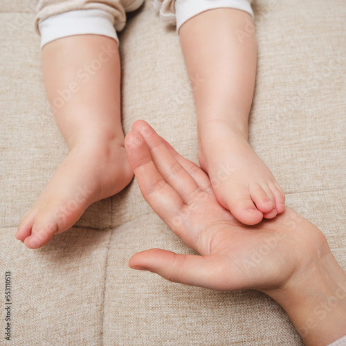 Cuadro en lienzo Deformed toes on the foot of the toddler baby, congenital curvature