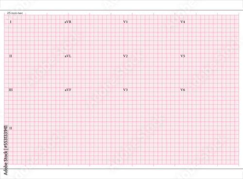 ECG Paper 12 Leads, electrocardiogram paper texture, millimeter paper texture, ECG paper texture