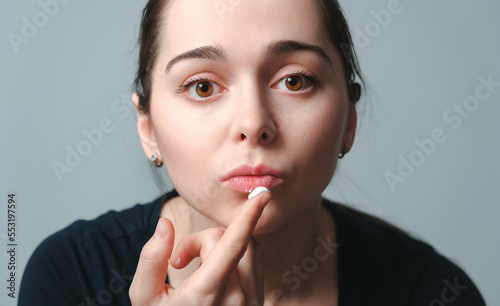 Virus herpes on lips close-up. Unhappy woman shows on a painful swollen lips. Portrait of young beautiful girl of European appearance with infection injury. Dermatology sickness. Facing treatment
