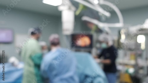 Unfocused view, obesity surgery in the operating room, Sleeve gastrectomy