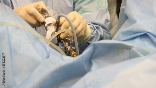 A high-tech instrument for urological operations using a laser in the hands of a surgeon photo
