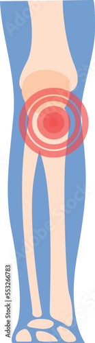 Knee arthritis icon cartoon vector. Joint pain. Medical doctor