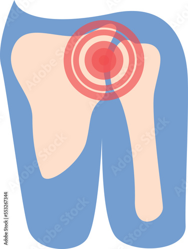 Shoulder pain icon cartoon vector. Arthritis joint. Patient medical