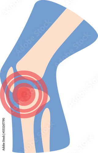 Articulation icon cartoon vector. Arthritis joint. Medical treatment