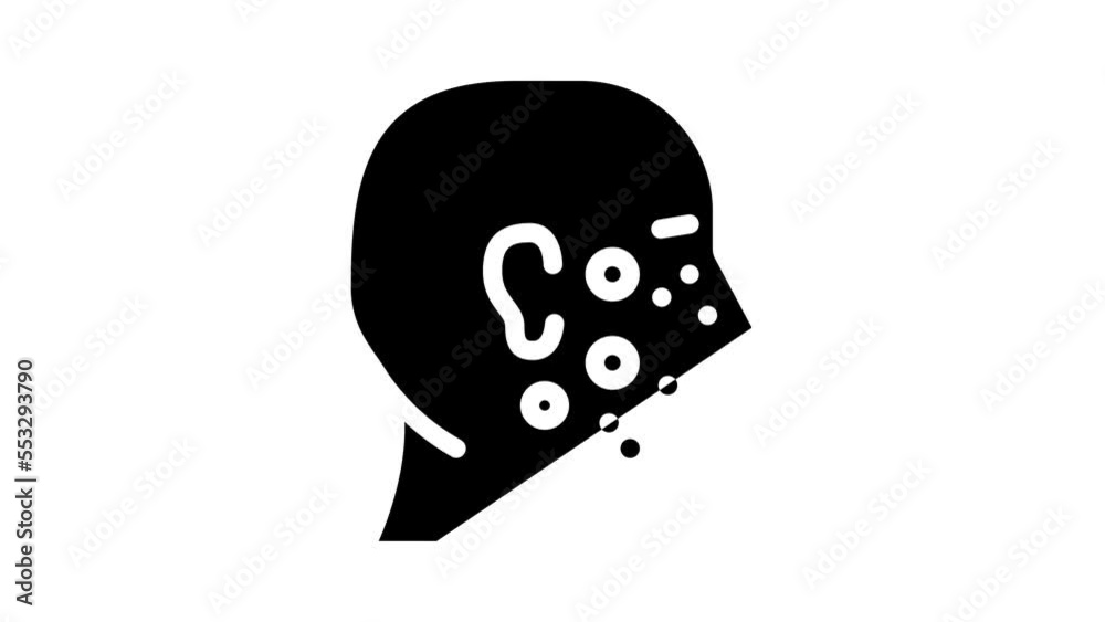 acne facial skin disease glyph icon animation acne facial skin disease glyph icon animation