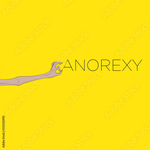 Anorexia nervosa is an eating disorder characterized by restricted food intake.