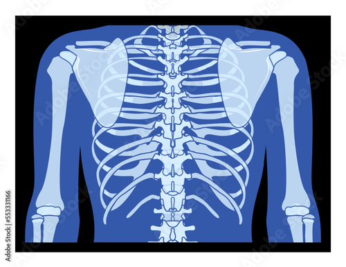X-Ray rib cage and hands Skeleton Human body Bones adult people roentgen back view. 3D realistic flat blue color concept Vector illustration of medical anatomy isolated on black background