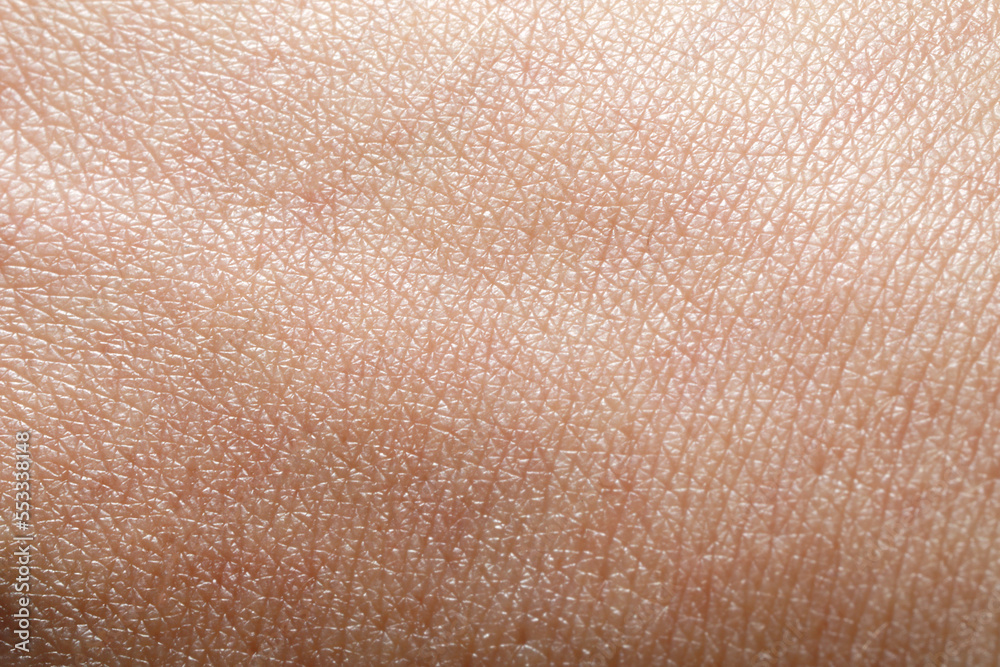 Closeup view of dry human skin as background