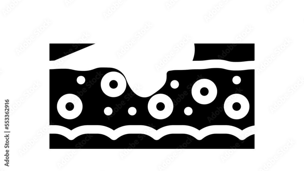 abstract problem skin disease glyph icon animation abstract problem skin disease glyph icon animation