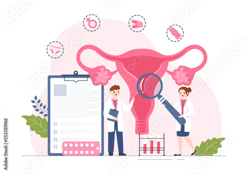 Endometriosis with Condition the Endometrium Grows Outside the Uterine Wall in Women for Treatment in Flat Cartoon Hand Drawn Templates Illustration