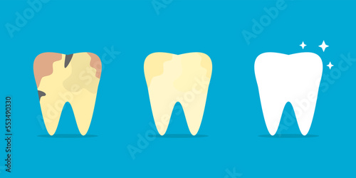 Set before after different tooth decay stains to white shiny clean tooth dental cartoon character on blue background icon flat vector design.