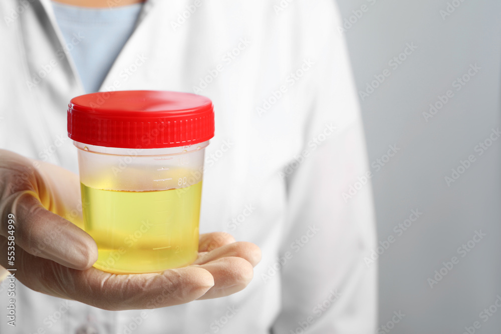 Doctor holding container with urine sample for analysis on grey background, closeup Doctor holding container with urine sample for analysis on grey background, closeup
