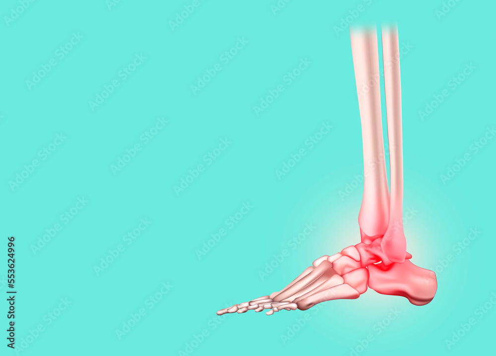 Ankle pain, inflammation, arthritis, gout, tendonitis, fracture, nerve