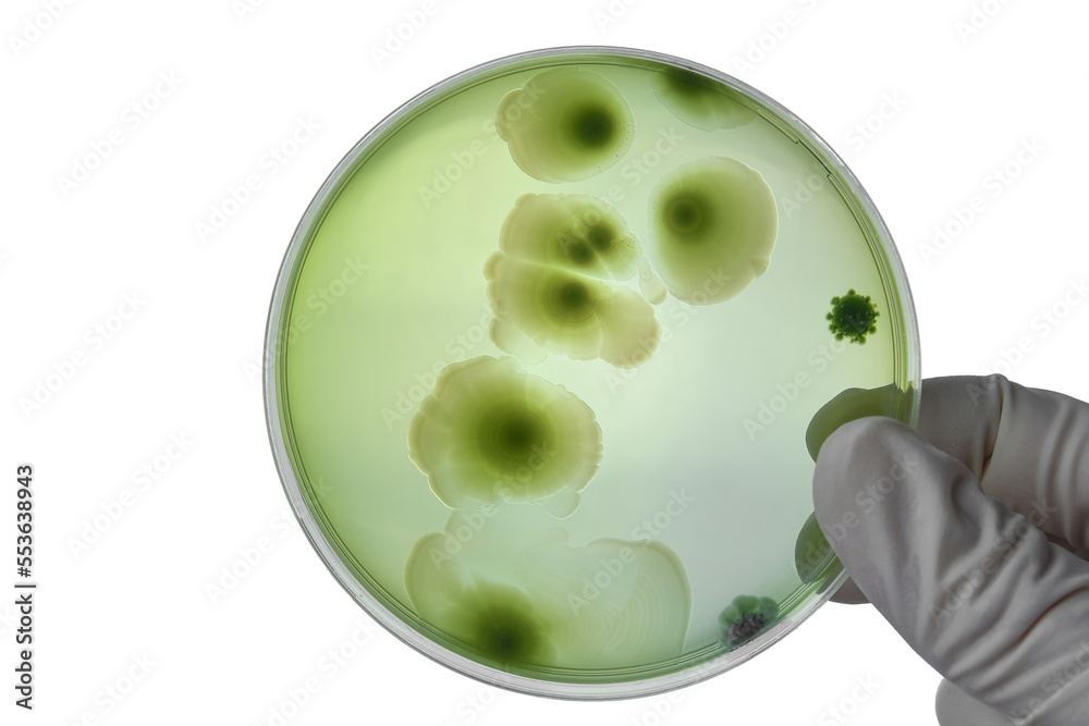 Hand with Petri dish or culture media with bacteria on white background ...
