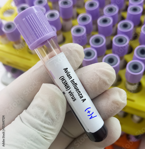 Blood Sample positive for Avian Influenza type A (H3N8) virus test, avian influenza virus (AIV), avian flu or bird flu. photo