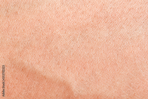 Abstract close-up human skin background texture.
