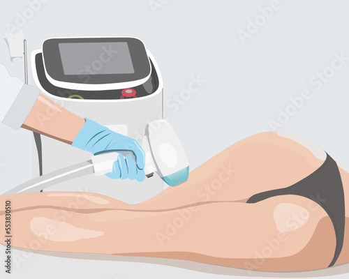 Illustration.Elos epilation, hair removal procedure on a woman’s body. Beautician doing laser rejuvenation in a beauty salon. Removing unwanted body hair. 