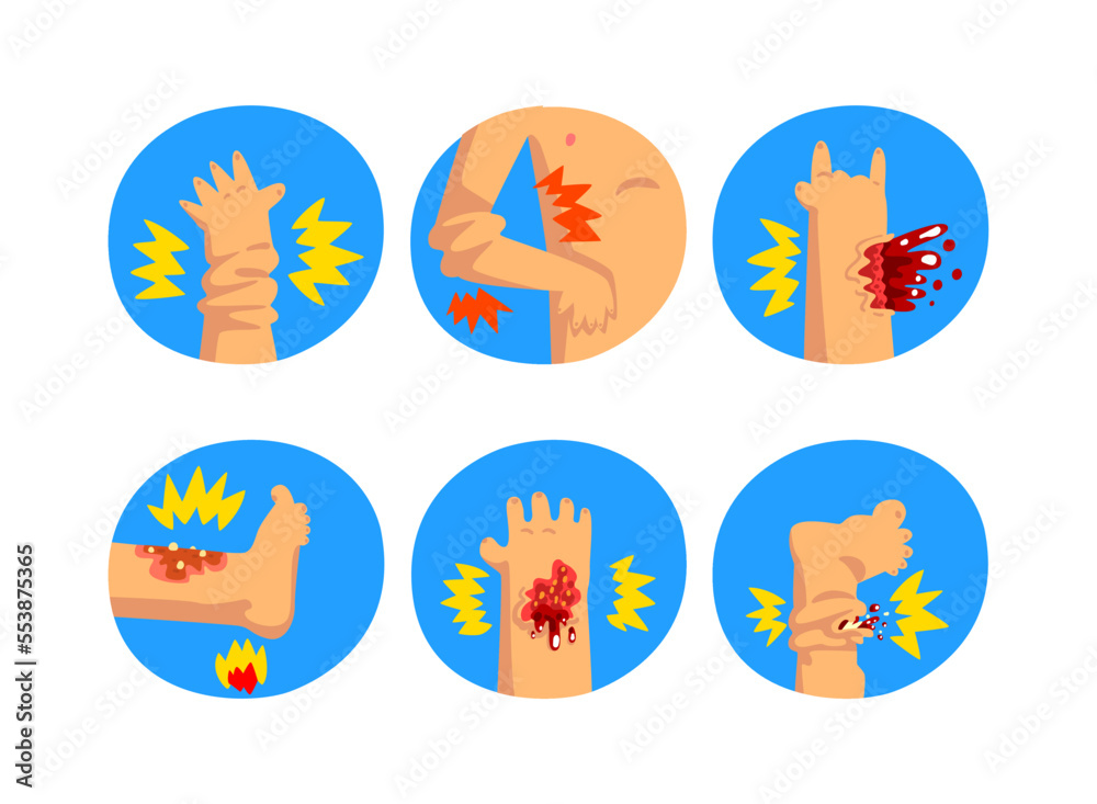 First Aid for Wounded Arm and Leg in Blue Circle Vector Set
