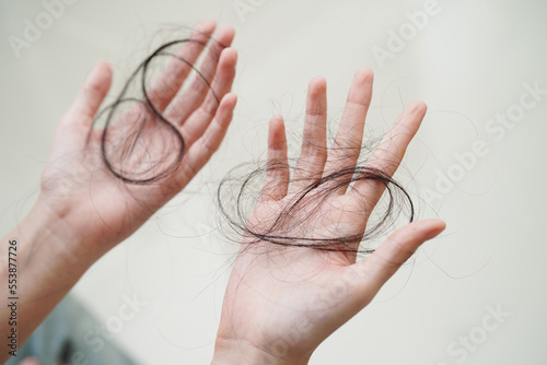 Canvas Print Asian woman have problem with long hair loss attach in her hand.