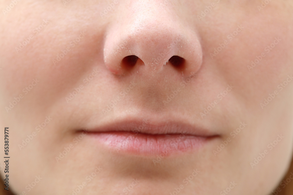 Woman with dry skin, closeup of mouth