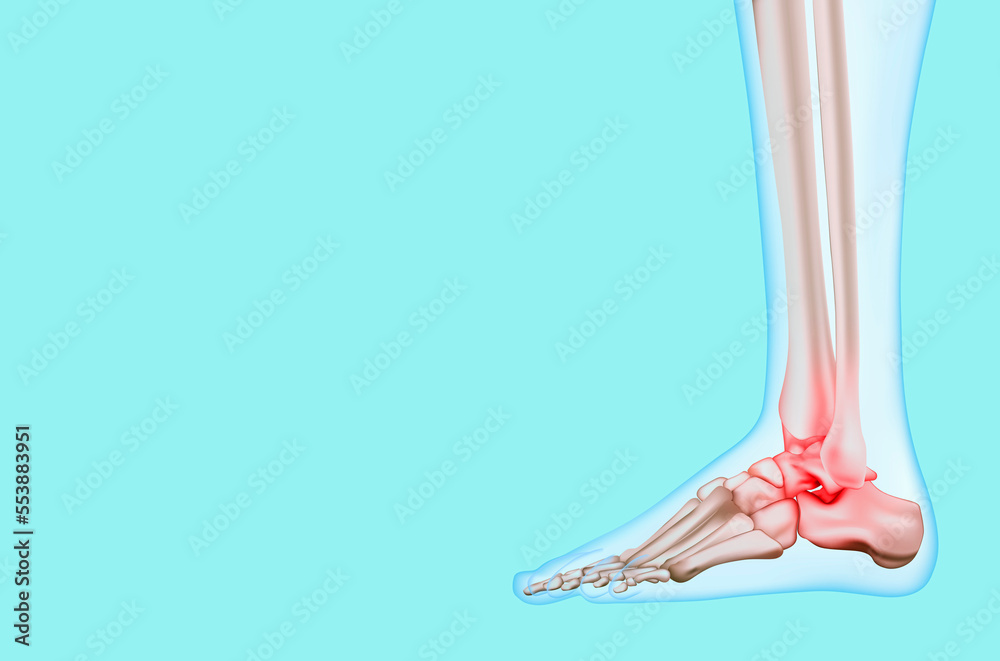 Ankle pain, inflammation, arthritis, osteosarcoma, gout, tendinitis ...