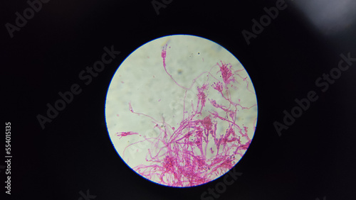Microscopic view of penicillium notatum fungus. 
