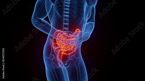 3D medical animation of a man experiencing abdominal pain