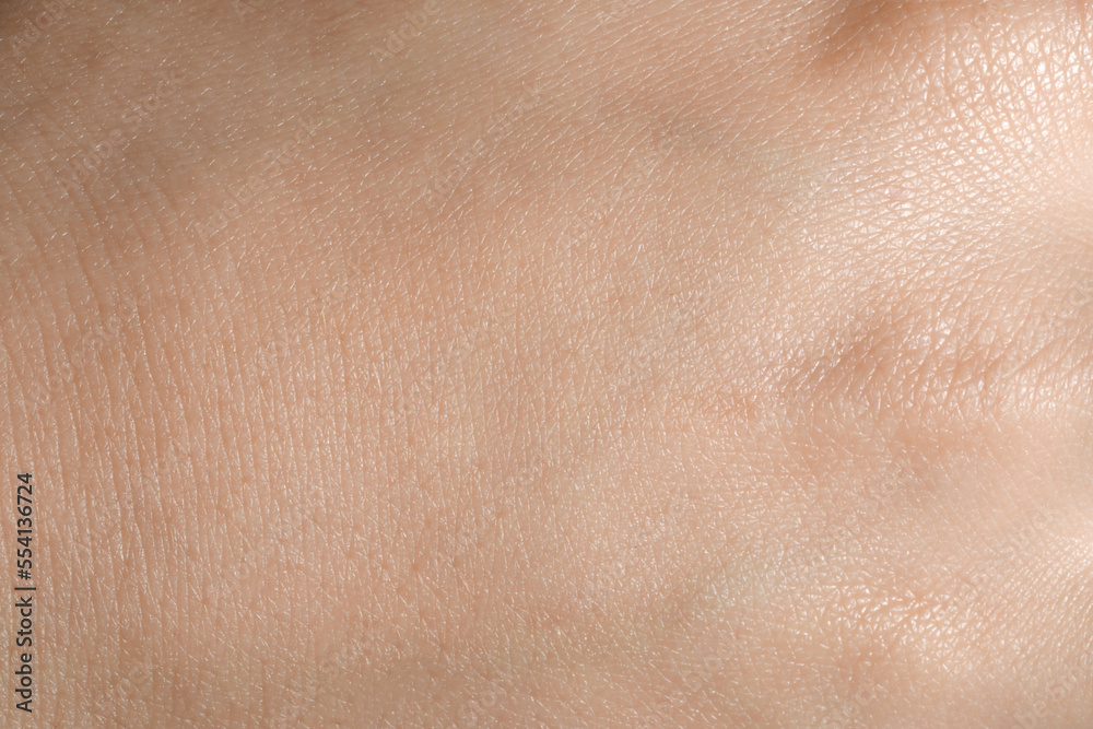Fototapeta premium Closeup view of dry human skin as background