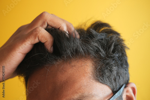 hair loss concept with man checking his hair 