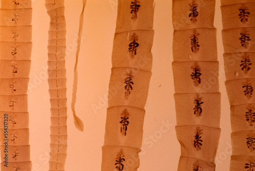 Close view of a broad fish tapeworm (Diphyllobothrium latum), a parasite that can grow up to 35 feet in length within a person's intestine.; United States.