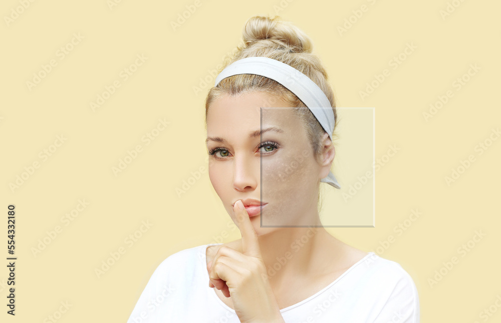 Dark spots, freckles,hyperpigmentation(melasma or chloasma),concept - skin lightening, skin whitening, fruit acids,AHA, Skin Brightening Dark spots, freckles,hyperpigmentation(melasma or chloasma),concept - skin lightening, skin whitening, fruit acids,AHA, Skin Brightening