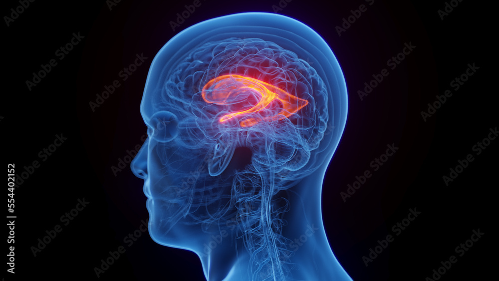 3D medical illustration of a man's lateral ventricle