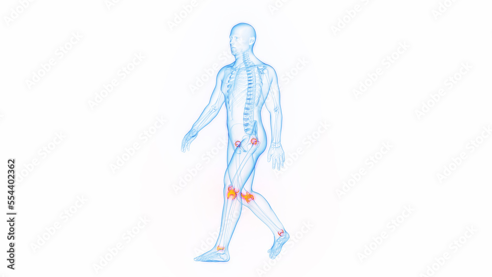 3D medical illustration of a man having joint pain while walking 3D medical illustration of a man having joint pain while walking