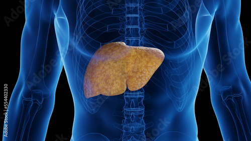 3D medical illustration of a man's fatty liver photo