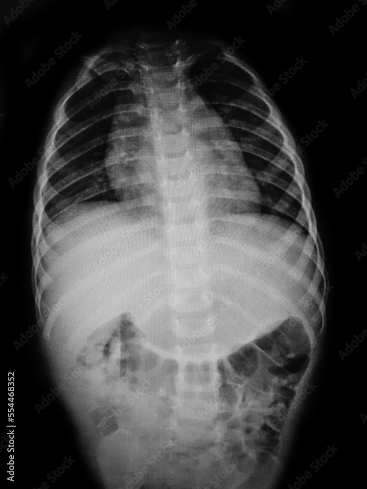 X- ray Major parts of the human body X- ray Major parts of the human body