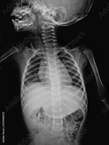X- ray Major parts of the human body