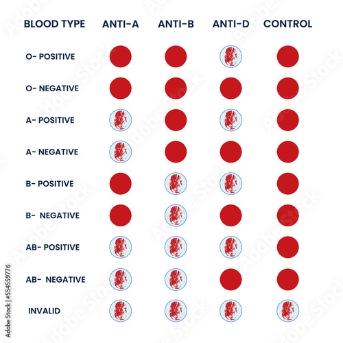 Biochemistry assay, enzyme immunoassay, laboratory test, chemical analysis. Immunology. Vector flat cartoon illustration. Blood test