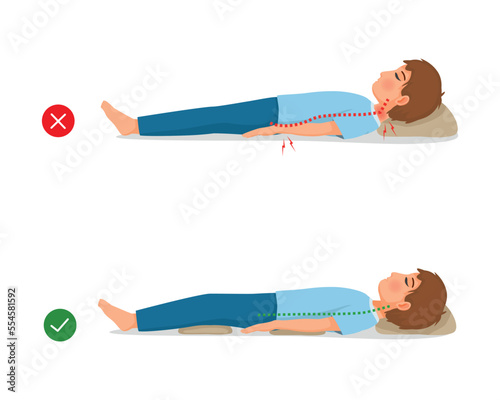 Incorrect and correct neck, spine and knee alignment of young man back sleeping body postures