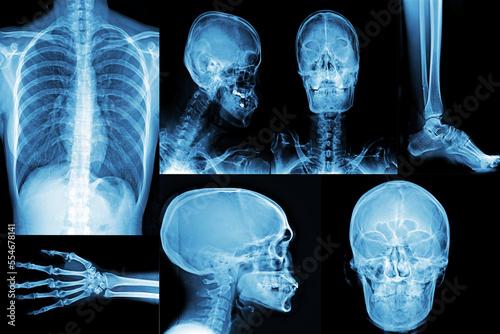 Collection X-ray  of human for medical