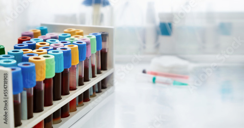 Workbench with tray with blood tests for examine in the hematology laboratory. Workplace Rack with tubes of blood samples from patients in the Clinical Analysis laboratory of the hospital