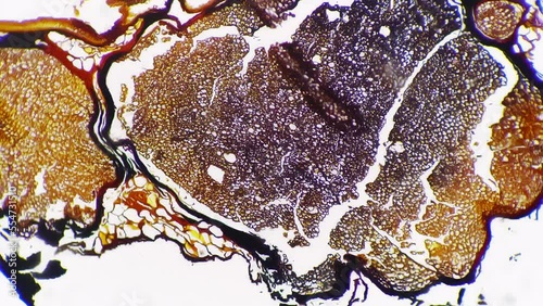 Silvering pattern of human nerves trunk in transversal section under microscope 100x on bright field. Isolated macro footage of fibers bundle of people nervous system. Medical research concept
