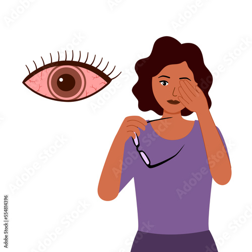 Black woman with eye pain in flat design on white background. Sore eye concept vector illustration.