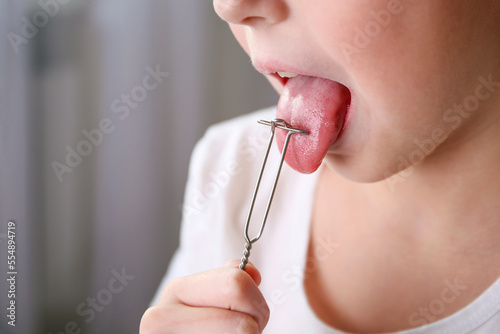 The child is given a tongue massage with a speech therapy probe. photo